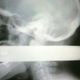 Illustration for article titled Motorist impaled by pole through head survives
